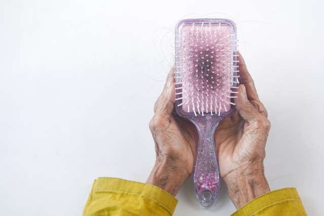 פתרונות יעילים לנשירת שיער בקרב תושבי העיר: מה שאתה צריך לדעת